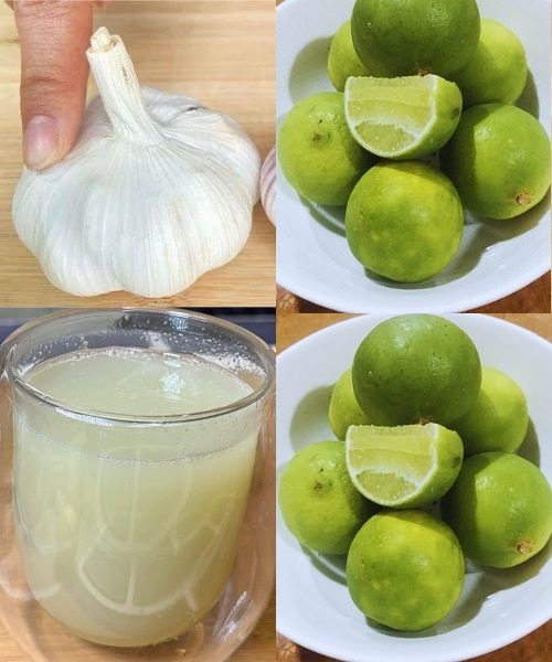 Grated Ginger, Onion, Garlic, Lemon Juice, and Honey: A Daily Health ...